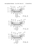 GLENOID IMPLANT WITH SYNTHETIC LABRUM diagram and image