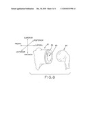 GLENOID IMPLANT WITH SYNTHETIC LABRUM diagram and image