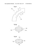 DEVICE FOR TREATING OBESITY diagram and image