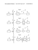 DEVICE FOR TREATING OBESITY diagram and image