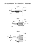 DEVICE FOR TREATING OBESITY diagram and image