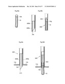 DEVICE FOR TREATING OBESITY diagram and image