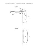 DEVICE FOR TREATING OBESITY diagram and image