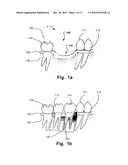 COMPUTER IMPLEMENTED PLANNING AND PROVIDING OF MASS CUSTOMIZED BONE STRUCTURE diagram and image