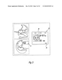 Systems and Methods for Providing Customized Dentures diagram and image