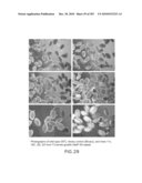 Cottonwood Growth eIF-5A diagram and image