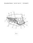 DEVICE FOR MANDIBULAR ADVANCEMENT diagram and image