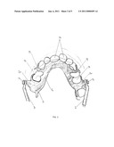 DEVICE FOR MANDIBULAR ADVANCEMENT diagram and image