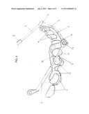 DEVICE FOR MANDIBULAR ADVANCEMENT diagram and image