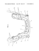 DEVICE FOR MANDIBULAR ADVANCEMENT diagram and image