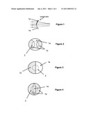 Contact lens and method for prevention of myopia progression diagram and image