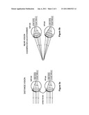 Contact lens and method for prevention of myopia progression diagram and image