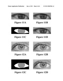 Eye Beautification diagram and image