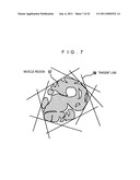 MEDICAL IMAGING PROCESSING DEVICE, MEDICAL IMAGE PROCESSING METHOD, AND PROGRAM diagram and image