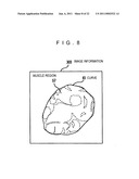 MEDICAL IMAGING PROCESSING DEVICE, MEDICAL IMAGE PROCESSING METHOD, AND PROGRAM diagram and image