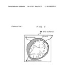 MEDICAL IMAGING PROCESSING DEVICE, MEDICAL IMAGE PROCESSING METHOD, AND PROGRAM diagram and image