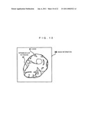 MEDICAL IMAGING PROCESSING DEVICE, MEDICAL IMAGE PROCESSING METHOD, AND PROGRAM diagram and image