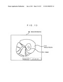 MEDICAL IMAGING PROCESSING DEVICE, MEDICAL IMAGE PROCESSING METHOD, AND PROGRAM diagram and image