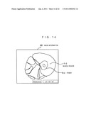 MEDICAL IMAGING PROCESSING DEVICE, MEDICAL IMAGE PROCESSING METHOD, AND PROGRAM diagram and image