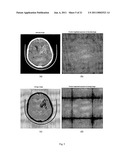  Method and System of Segmenting CT Scan Data diagram and image