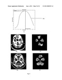  Method and System of Segmenting CT Scan Data diagram and image