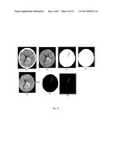  Method and System of Segmenting CT Scan Data diagram and image