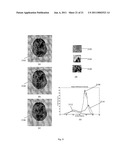  Method and System of Segmenting CT Scan Data diagram and image