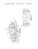 CHAIN TENSIONER diagram and image