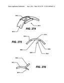 ATHLETIC WATCH diagram and image