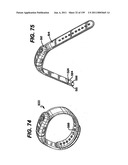 ATHLETIC WATCH diagram and image