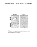 MINERALCORTICOID RECEPTOR ANTAGONISTS FOR THE TREATMENT OF ENDOMETRIOSIS diagram and image
