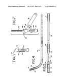 Methods And Apparatus for Intraocular Brachytherapy diagram and image