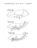 Methods And Apparatus for Intraocular Brachytherapy diagram and image