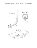 Methods And Apparatus for Intraocular Brachytherapy diagram and image