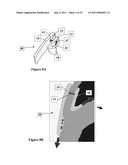  BOLSTER FOR SECURING A SEPTAL SPLINT TO A CARDIAC WALL, A METHOD OF USE THEREOF, AND A SYSTEM INCLUDING THE SAME diagram and image