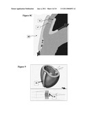  BOLSTER FOR SECURING A SEPTAL SPLINT TO A CARDIAC WALL, A METHOD OF USE THEREOF, AND A SYSTEM INCLUDING THE SAME diagram and image