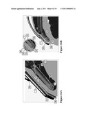  BOLSTER FOR SECURING A SEPTAL SPLINT TO A CARDIAC WALL, A METHOD OF USE THEREOF, AND A SYSTEM INCLUDING THE SAME diagram and image