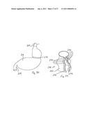 Gastric Constriction Device diagram and image