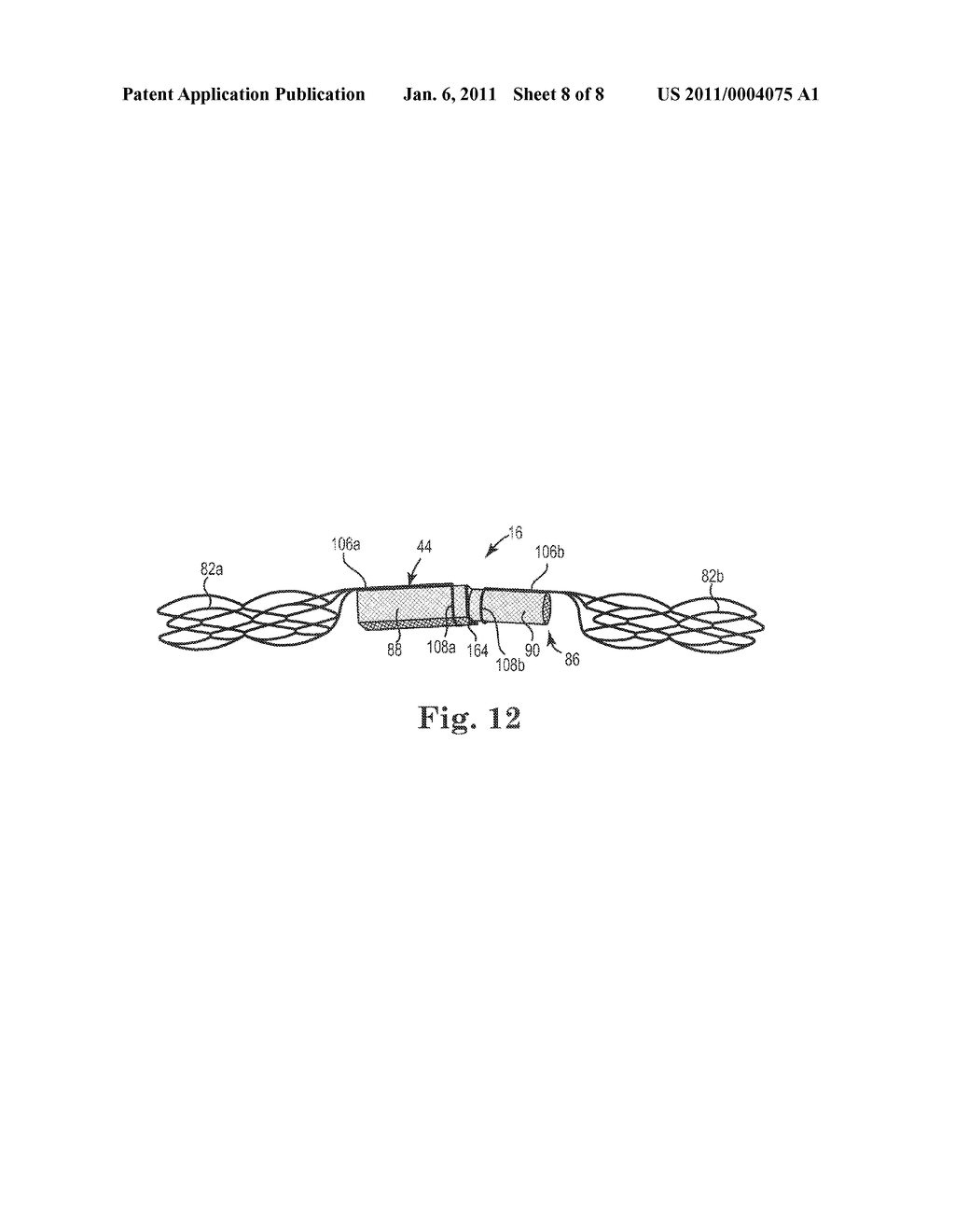 VASCULAR PRESSURE SENSOR WITH ELECTROCARDIOGRAM ELECTRODES - diagram, schematic, and image 09