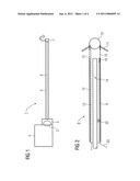 Intravenous Pacemaker Electrode diagram and image