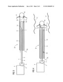 Intravenous Pacemaker Electrode diagram and image