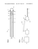 Intravenous Pacemaker Electrode diagram and image