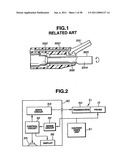 Ultrasound treatment system diagram and image