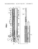 Ultrasound treatment system diagram and image