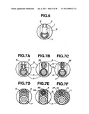 Ultrasound treatment system diagram and image