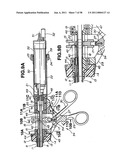 Ultrasound treatment system diagram and image