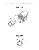 Ultrasound treatment system diagram and image