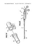 Ultrasound treatment system diagram and image