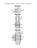 Ultrasound treatment system diagram and image