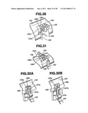 Ultrasound treatment system diagram and image